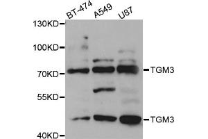 Western blot analysis of extracts of various cell lines, using TGM3 antibody (ABIN5973467) at 1/1000 dilution. (TGM3 Antikörper)