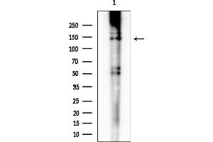 Western blot analysis of lysates from HUVEC cells, using c-Met Mouse Monoclonal Antibody at 1/1000 dilution.