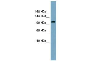 WB Suggested Anti-ELP2 Antibody Titration: 0. (ELP2 Antikörper  (Middle Region))