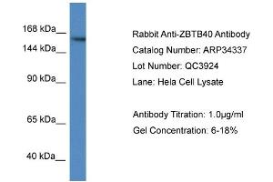 WB Suggested Anti-ZBTB40 Antibody   Titration: 1.
