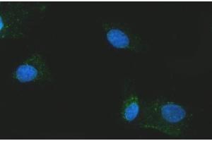IF analysis of Citrin/SLC25A13 using anti-Citrin/SLC25A13 antibody (ABIN7599512). (slc25a13 Antikörper  (AA 1-643))