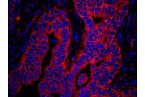 Immunofluorescence (IF) image for anti-RpL7a/SURF3 (C-Term) antibody (ABIN7449015) (RpL7a/SURF3 (C-Term) Antikörper)