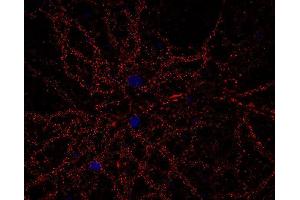 Immunocytochemistry (ICC) image for anti-Calcium Channel, Voltage-Dependent, N Type, alpha 1B Subunit (CACNA1B) (alpha-1E subunit) antibody (ABIN4889903)