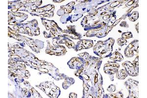 Immunohistochemistry (IHC) image for anti-Fms-Related Tyrosine Kinase 4 (FLT4) (AA 25-259) antibody (ABIN5693136)