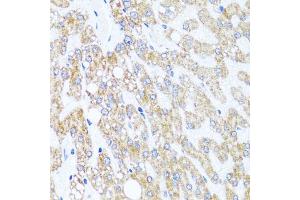 Immunohistochemistry of paraffin-embedded human liver injury using CHD1 antibody (ABIN5975217) at dilution of 1/100 (40x lens). (CHD1 Antikörper)