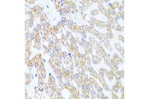 Immunohistochemistry of paraffin-embedded human liver injury using CHD1 antibody (ABIN5975217) at dilution of 1/100 (40x lens).