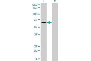 Western Blotting (WB) image for anti-Malic Enzyme 1, NADP(+)-Dependent, Cytosolic (ME1) (AA 1-573) antibody (ABIN598801) (ME1 Antikörper  (AA 1-573))