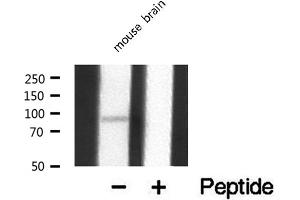 Western blot analysis of extracts from mouse Brian, using MEKKK 1 antibody. (MAP4K1 Antikörper  (Internal Region))