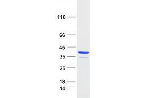 Western Blotting (WB) image for AlkB, Alkylation Repair Homolog 2 (ALKBH2) (Transcript Variant 2) protein (Myc-DYKDDDDK Tag) (ABIN2714576)