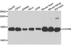 Western blot analysis of extract of various cells, using COX5B antibody. (COX5B Antikörper)