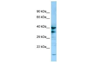 WB Suggested Anti-P2RY13 Antibody Titration: 1. (Purinergic Receptor P2Y, G-Protein Coupled, 13 (P2RY13) (C-Term) Antikörper)