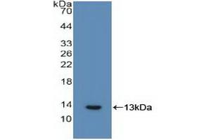 Western blot analysis of recombinant Human IL6R. (IL-6 Receptor Antikörper  (AA 216-356))