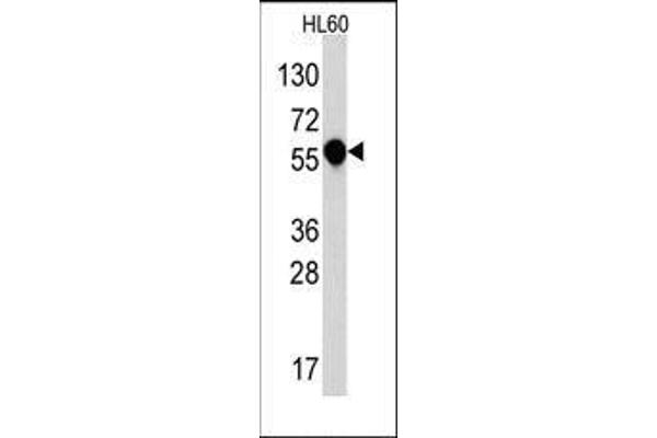 IL1RL2 抗体  (C-Term)