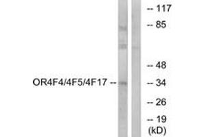 Western blot analysis of extracts from MCF-7 cells, using OR4F4/4F5/4F17 Antibody. (OR4F4/4F5/4F17 Antikörper  (AA 51-100))