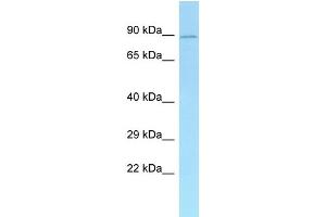 WB Suggested Anti-Add1 Antibody Titration: 1. (alpha Adducin Antikörper  (N-Term))