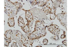 Immunoperoxidase of monoclonal antibody to ZNF265 on formalin-fixed paraffin-embedded human placenta. (ZNF265 Antikörper  (AA 1-106))