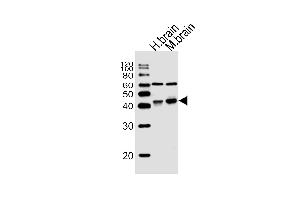 Western blot analysis of lysates from human brain, mouse brain tissue (from left to right), using WNT16 Antibody (C-term) (ABIN657146 and ABIN2846282). (WNT16 Antikörper  (C-Term))