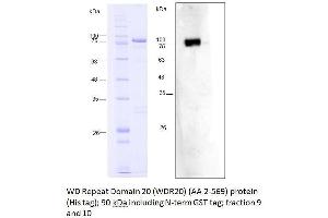 Western Blotting (WB) image for WD Repeat Domain 20 (WDR20) (AA 2-569) protein (His tag,GST tag) (ABIN3104201) (WDR20 Protein (AA 2-569) (His tag,GST tag))