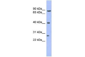 WB Suggested Anti-BRD3 Antibody Titration:  0. (BRD3 Antikörper  (Middle Region))