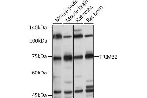 Western blot analysis of extracts of various cell lines, using TRIM32 antibody (ABIN6132735, ABIN6149520, ABIN6149521 and ABIN6222878) at 1:500 dilution. (TRIM32 Antikörper  (AA 1-280))