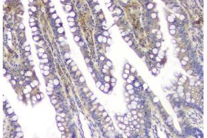 IHC analysis of SQSTM1 using anti-SQSTM1 antibody (ABIN3043937). (SQSTM1 Antikörper  (N-Term))