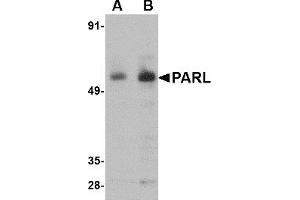 Western Blotting (WB) image for anti-Presenilin Associated, Rhomboid-Like (PARL) (N-Term) antibody (ABIN1031504) (PARL Antikörper  (N-Term))