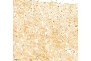 Immunohistochemistry (Paraffin-embedded Sections) (IHC (p)) image for anti-Collagen, Type V (COL5) antibody (ABIN7073547)