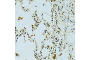 Immunohistochemistry of paraffin-embedded rat lung using RSRC1 antibody (ABIN5974341) at dilution of 1/100 (40x lens). (RSRC1 Antikörper)