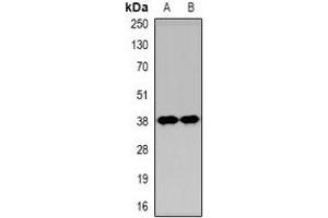 Western blot analysis of KIM1 expression in Hela (A), HEK293T (B) whole cell lysates. (HAVCR1 Antikörper  (N-Term))