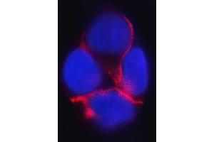 anti-Catenin (Cadherin-Associated Protein), delta 1 (CTNND1) (AA 64-930) antibody