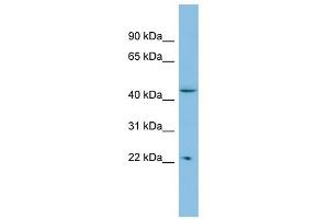 POLR1E antibody used at 1 ug/ml to detect target protein. (POLR1E Antikörper)
