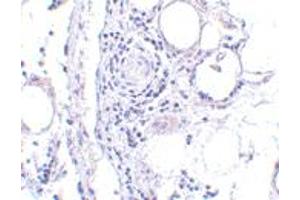 Immunohistochemistry of FABP7 in human breast tissue with FABP7 polyclonal antibody  at 5 ug/mL . (FABP7 Antikörper  (Internal Region))