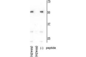 Western blot of HeLa lysate showing specific immunolabeling of the ~52 kDa Mnk2a isoform in the third lane (-). (MKNK2 Antikörper  (C-Term))