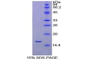 SDS-PAGE analysis of Chicken Transthyretin Protein.