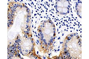 Immunohistochemistry (Paraffin-embedded Sections) (IHC (p)) image for anti-Catenin, beta (CATNB) antibody (ABIN7249752)