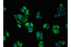 Immunofluorescent analysis of HepG2 cells using ABIN7155192 at dilution of 1:100 and Alexa Fluor 488-congugated AffiniPure Goat Anti-Rabbit IgG(H+L) (TRKA Antikörper  (AA 33-208))