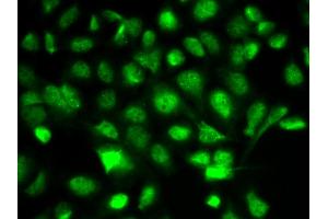 Immunofluorescence analysis of A549 cells using BIRC2 antibody (ABIN6292780). (BIRC2 Antikörper)