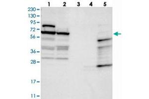 Western blot analysis of Lane 1: RT-4, Lane 2: U-251 MG, Lane 3: Human Plasma, Lane 4: Liver, Lane 5: Tonsil with NOP5/NOP58 polyclonal antibody  at 1:250-1:500 dilution. (NOP58 Antikörper)