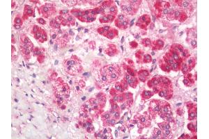 Immunohistochemistry (Paraffin-embedded Sections) (IHC (p)) image for anti-Major Histocompatibility Complex, Class II, DQ alpha 1 (HLA-DQA1) antibody (Biotin) (ABIN2606272)