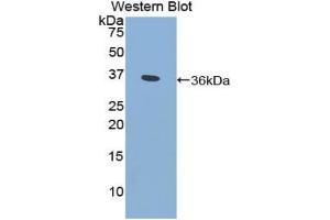 Detection of Recombinant CYP21A2, Human using Polyclonal Antibody to Cytochrome P450 Family 21 Subfamily A Member 2 (CYP21A2) (CYP21A2 Antikörper  (AA 106-389))