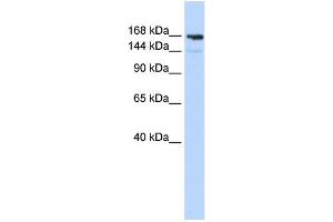 WB Suggested Anti-PPL Antibody Titration:  0. (PPL Antikörper  (Middle Region))