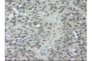 Image no. 5 for anti-Budding Uninhibited By Benzimidazoles 1 Homolog beta (Yeast) (BUB1B) antibody (ABIN1497000) (BUB1B Antikörper)