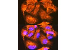 Immunofluorescence analysis of U-2 OS cells using PHKG2 Rabbit pAb  at dilution of 1:100 (40x lens). (PHKG2 Antikörper  (AA 237-406))