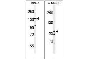 Western Blotting (WB) image for anti-TAF2 RNA Polymerase II, TATA Box Binding Protein (TBP)-Associated Factor, 150kDa (TAF2) (AA 1159-1188), (C-Term) antibody (ABIN955066)