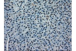 Immunohistochemical staining of paraffin-embedded pancreas tissue using anti-MAPK1mouse monoclonal antibody.