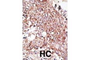 Immunohistochemistry (Paraffin-embedded Sections) (IHC (p)) image for anti-Lymphatic Vessel Endothelial Hyaluronan Receptor 1 (LYVE1) (AA 243-272), (C-Term) antibody (ABIN388752)