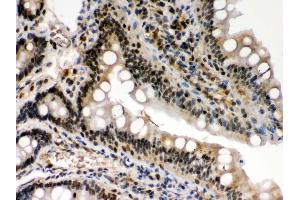 IHC(P): Rat Intestine Tissue (c-Rel Antikörper  (Middle Region))