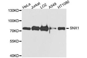 Western blot analysis of extracts of various cell lines, using SNX1 antibody. (Sorting Nexin 1 Antikörper  (AA 1-150))