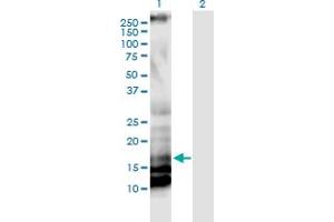 Western Blot analysis of IL17A expression in transfected 293T cell line by IL17A monoclonal antibody (M01), clone 3G5.
