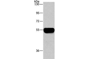 Western Blot analysis of Human plasma tissue using AHSG Polyclonal Antibody at dilution of 1:1450 (Fetuin A Antikörper)